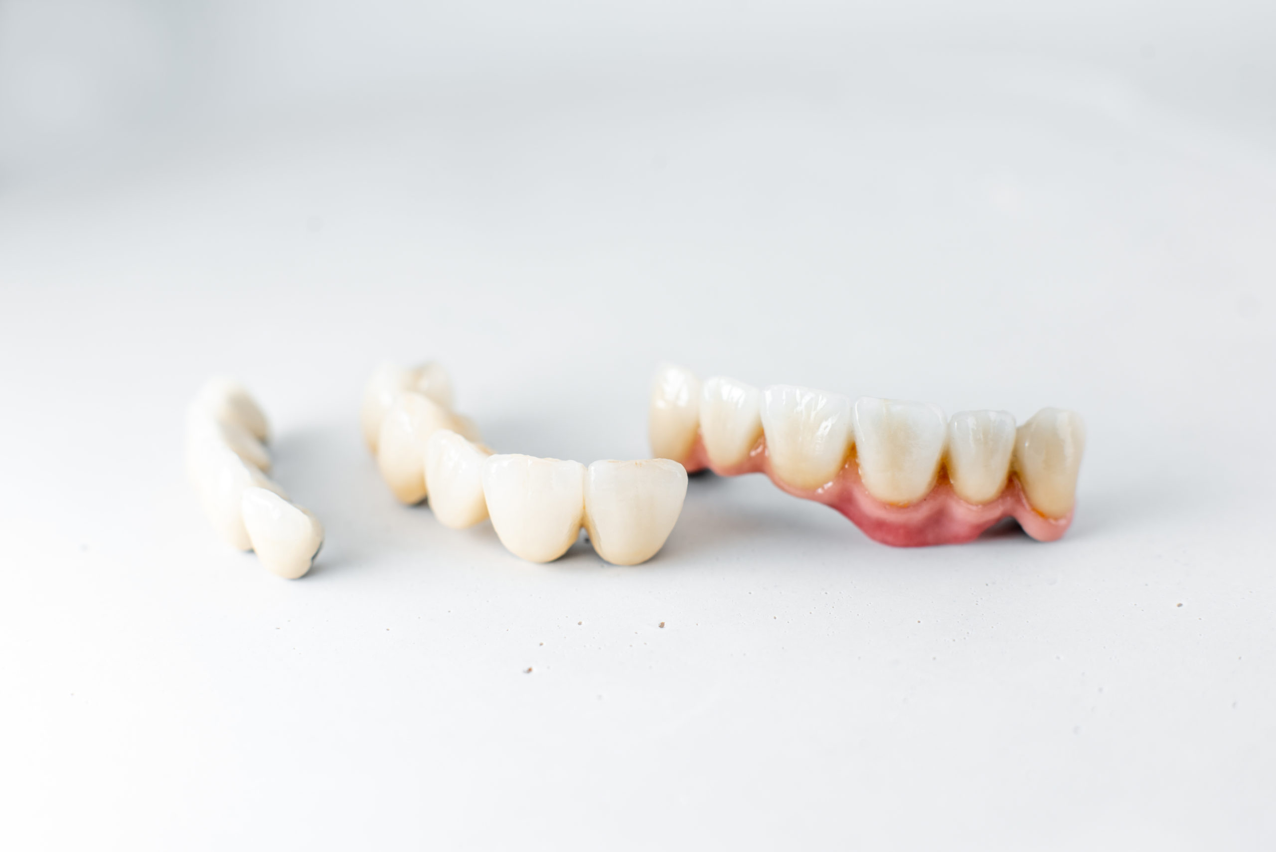 Dental crowns Honolulu