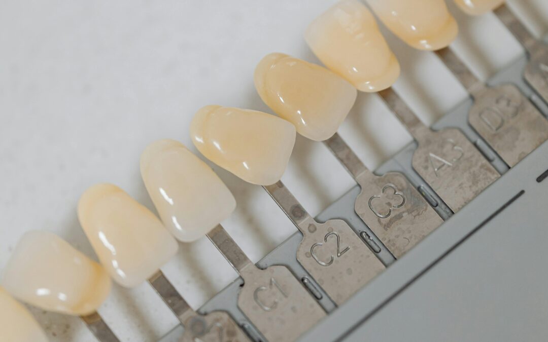 Get to Know Different Types of Dental Implants