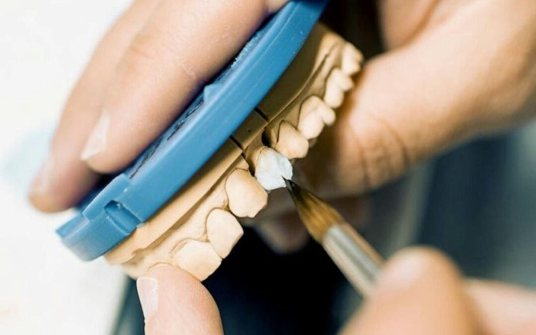 How Painful Are Dental Implants?