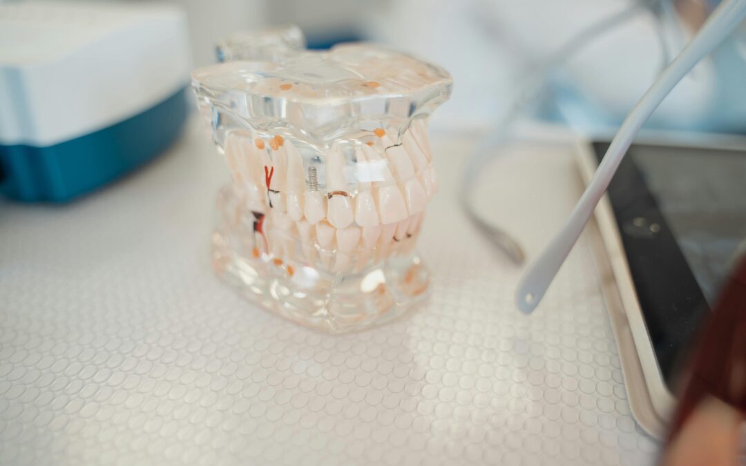 Are Dental Implants Worth It? Absolutely