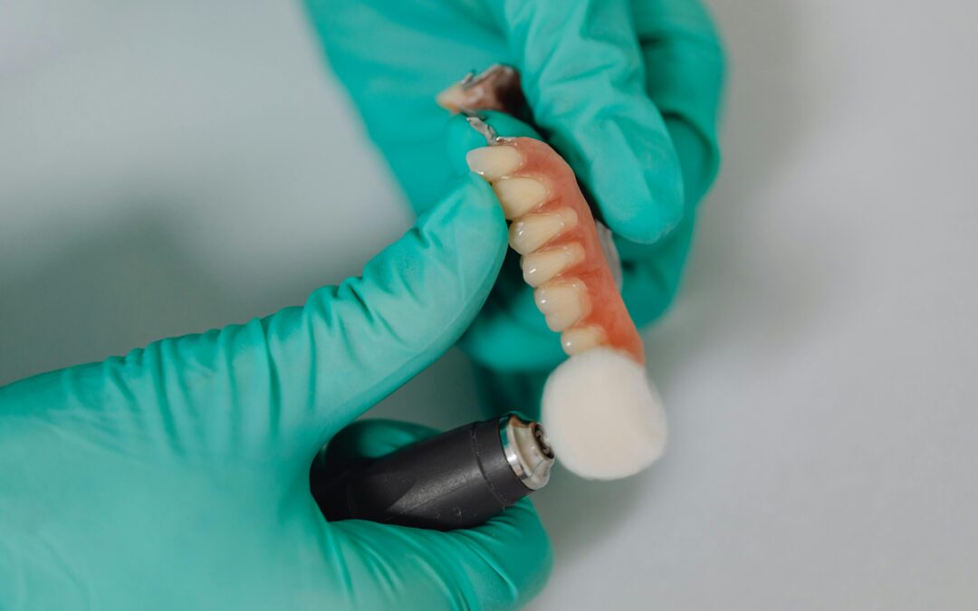 dental implants